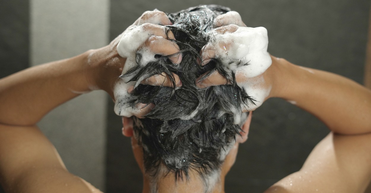 Perché ho la forfora anche se lavo i capelli ogni giorno?